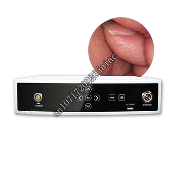 LHPDVI Pigiai USB HD Skaitmeninis Pet Endoskopų Medicinos 1080P Endoskopą Sistema ENT